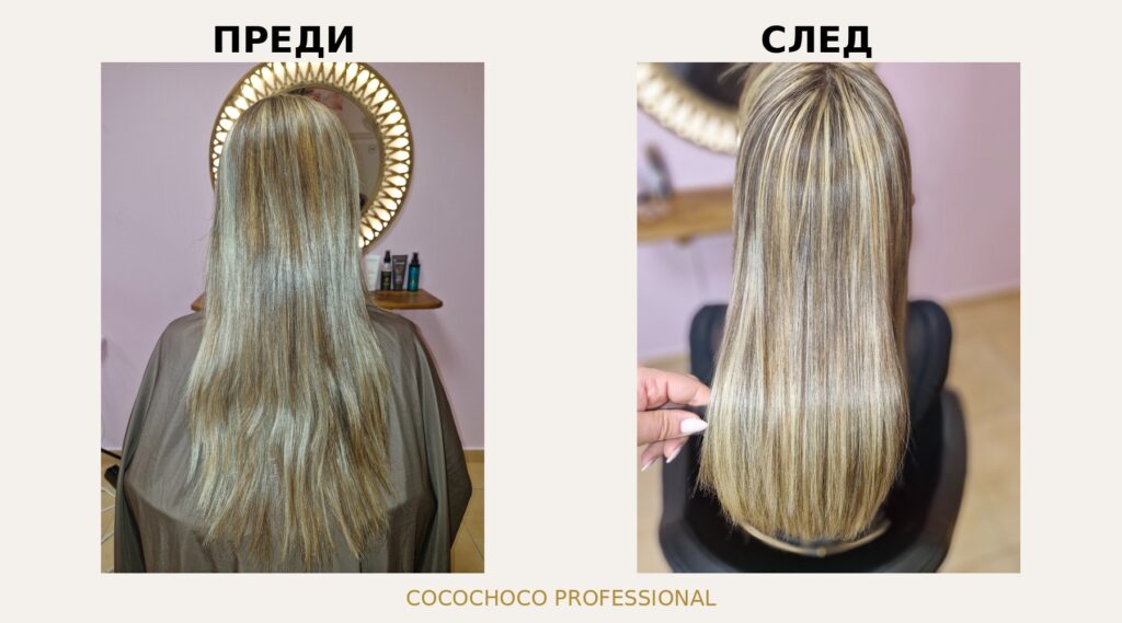 Ботокс терапия преди и след